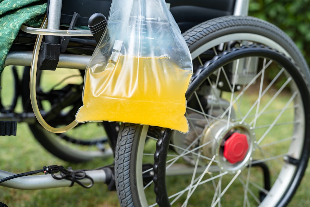Les impacts de la crise sanitaire sur le business des poches urinaires
